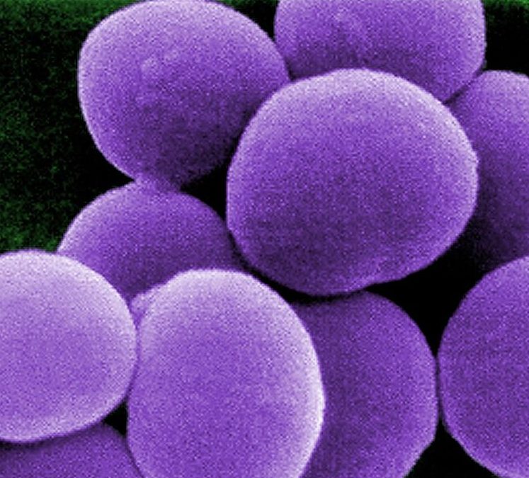 Repeat Staph Infections: Public Health Threat, Immunologic Puzzle