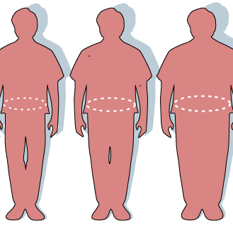 The Childhood Obesity Epidemic