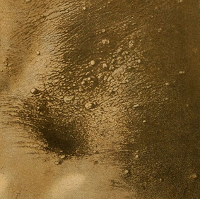Acanthosis nigricans: Skin conditions and obesity